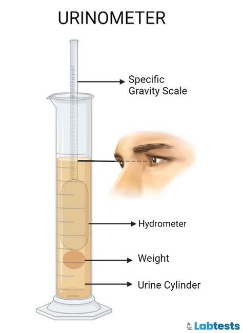 a urinometer or a refractometer is ued to measure the|how to use a urinometer.